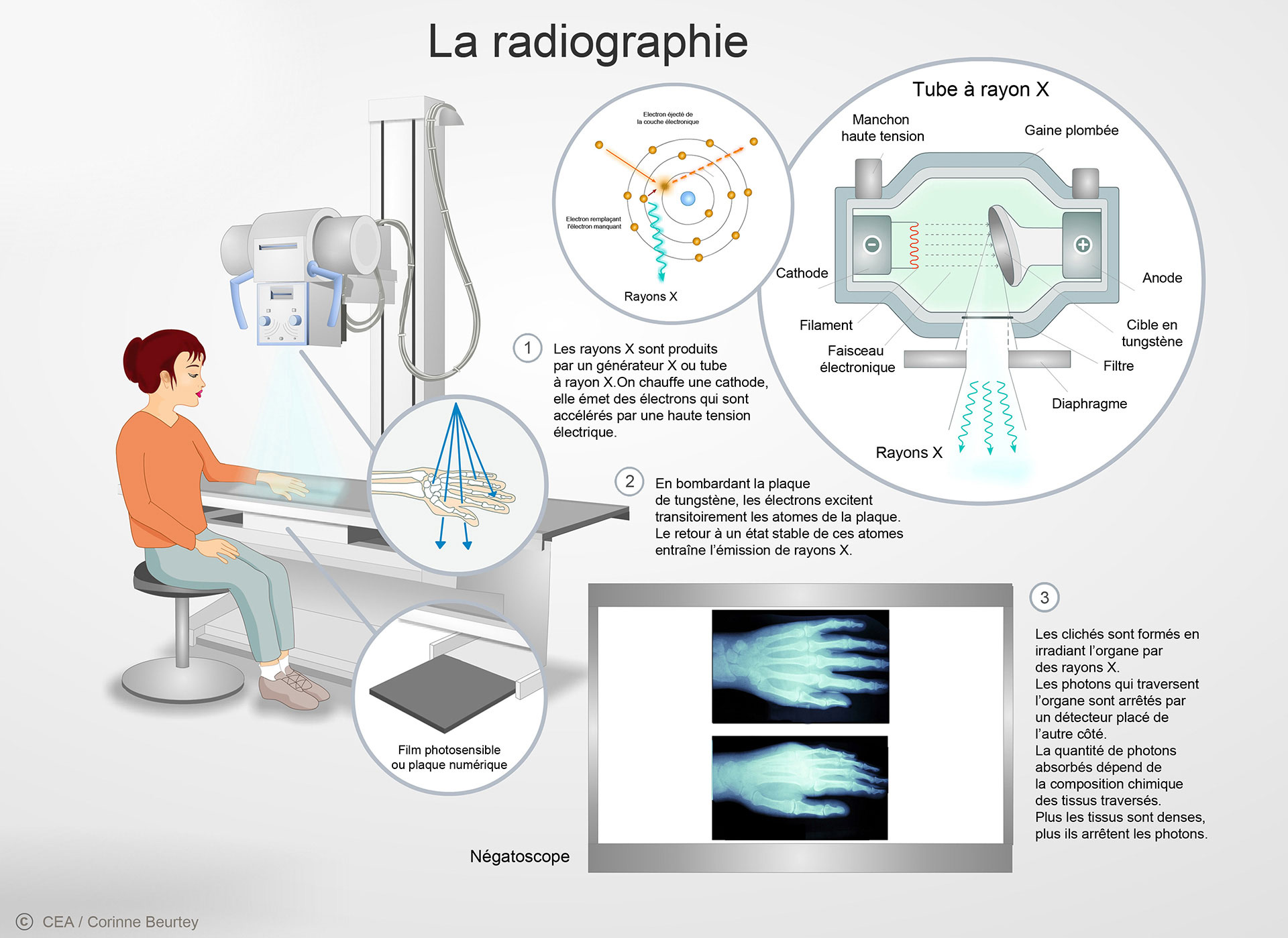 Le principe de la radiographie