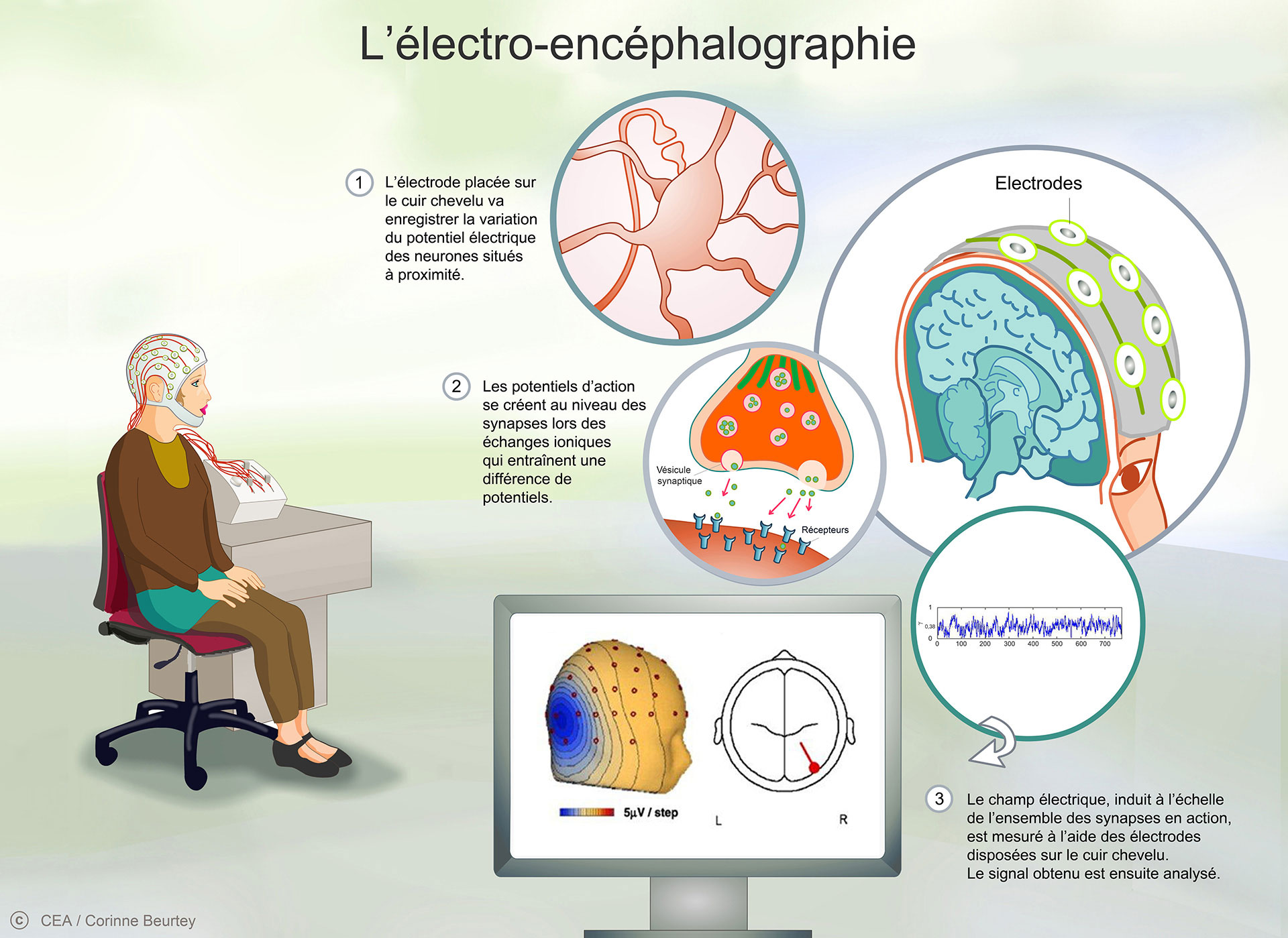 Le principe de l'électro-encéphalographie