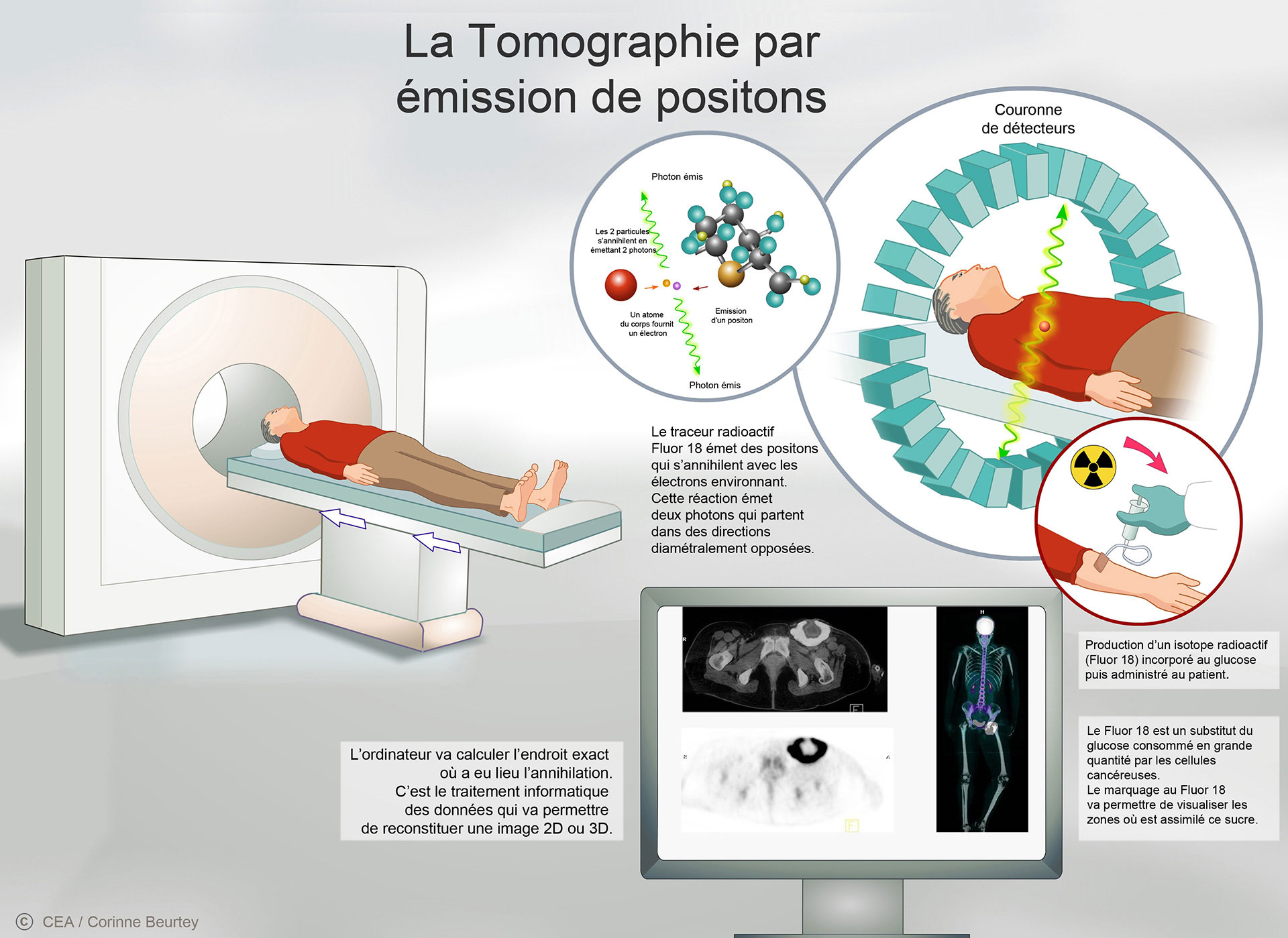 Le principe de la tomographie par émission de positons