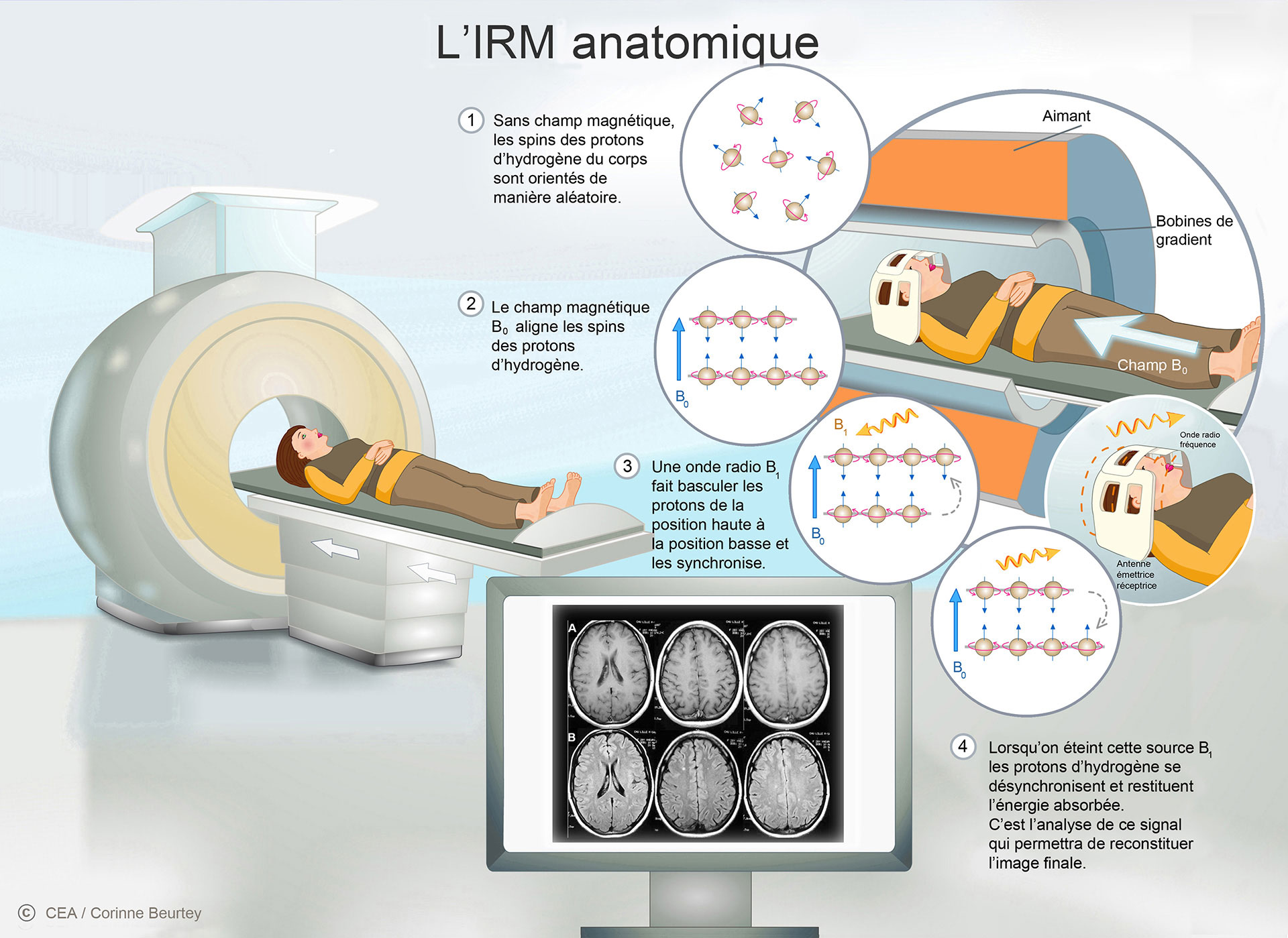 Le principe de l'IRM anatomique